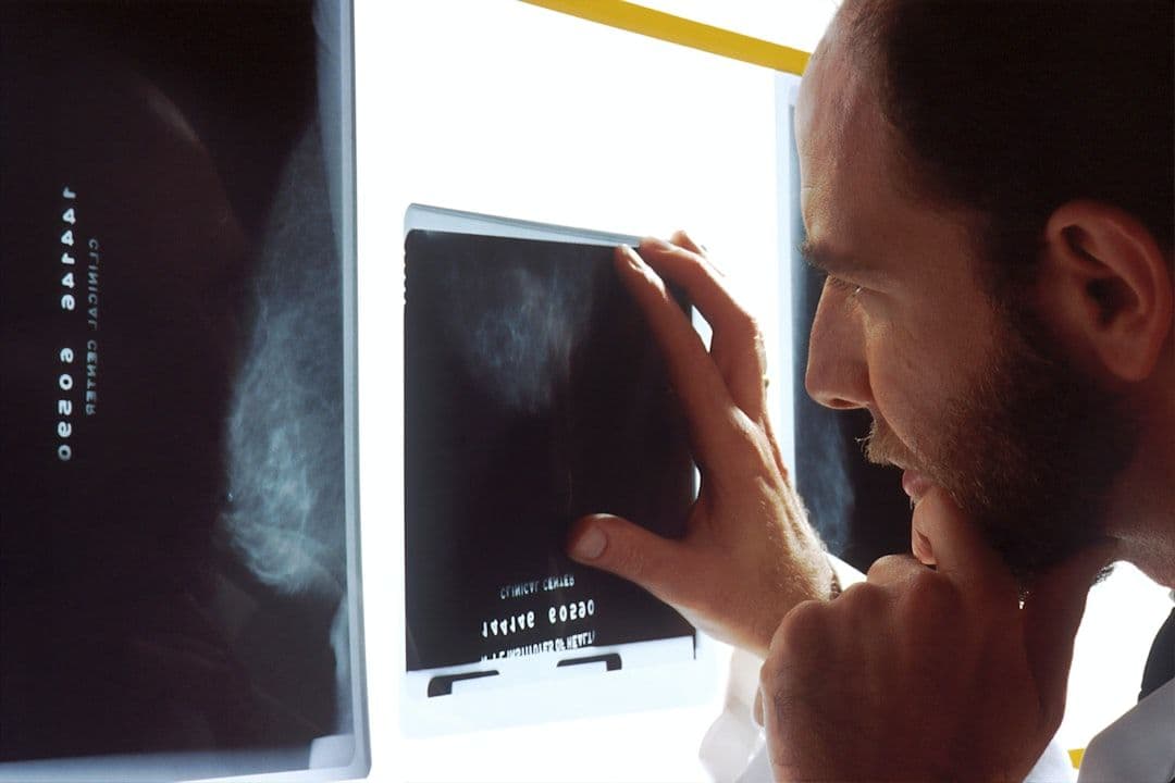 Jeremy Clarkson's Prostate Cancer: What Men Should Know